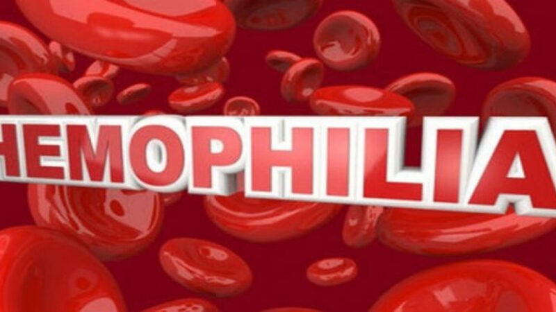 Bệnh Hemophilia A là gì?