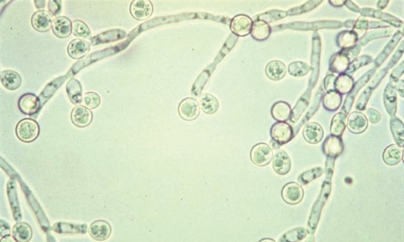 Nhiễm trùng nấm men Candida cũng là nguyên nhân hàng đầu